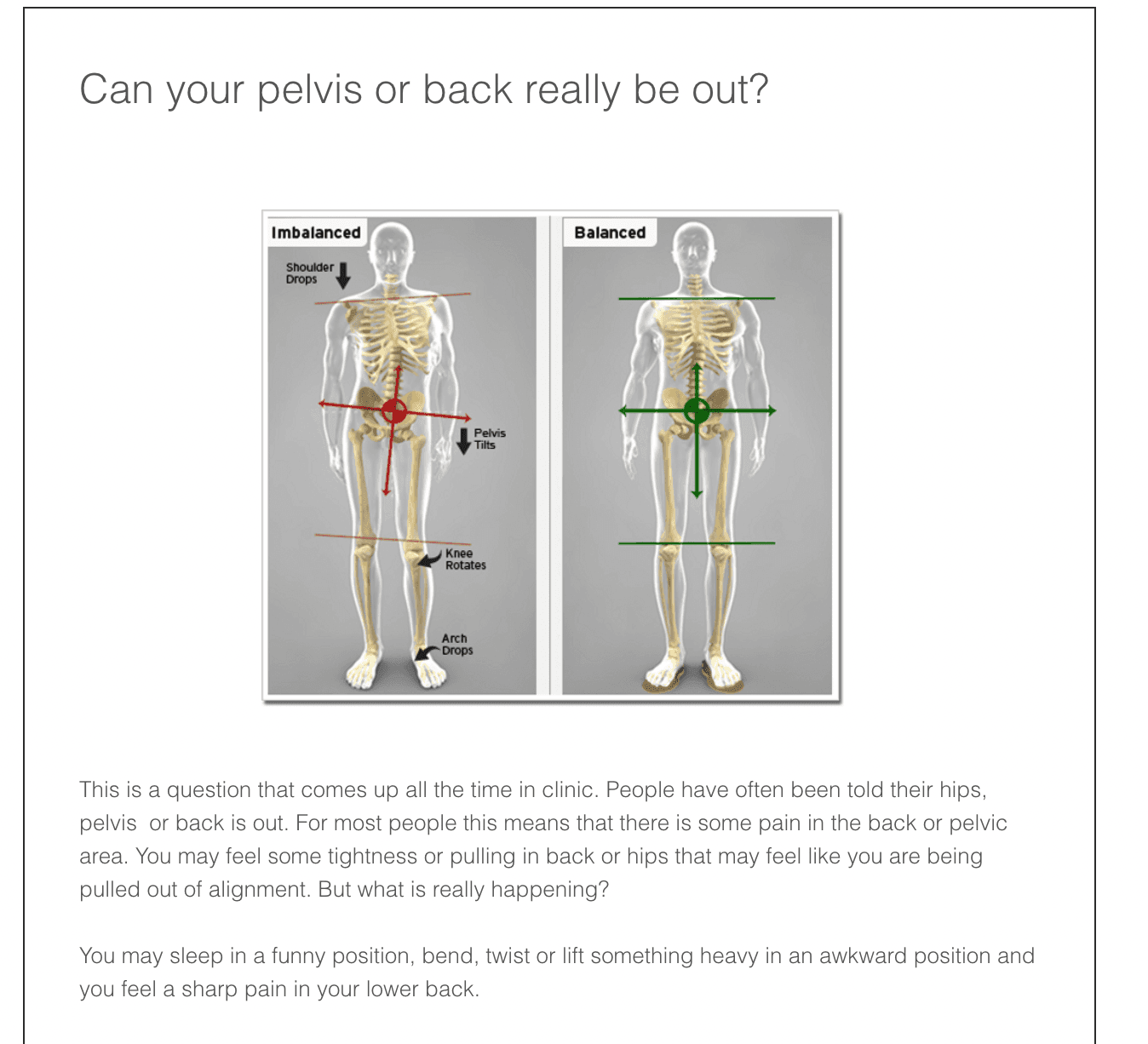 Comparison of imbalanced and balanced skeletal posture with highlighted alignment issues.